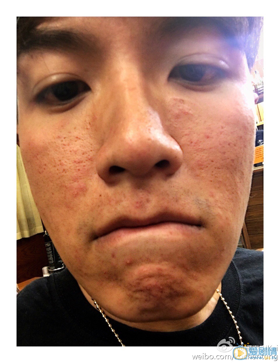 柯震东对嘴卖萌照 柯震东高清写真_柯震东高清剧照