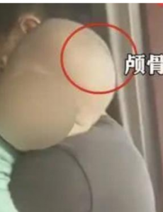 官方:未发现医生参与假奶粉事件相关内容