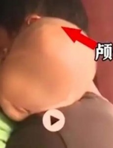 特医奶粉乱象何来是什么情况