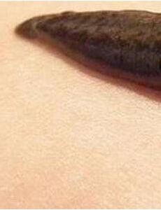 世界上最恐怖的吸血生物是什么：暴君水蛭，丛林恐怖杀手(人类多次中招)