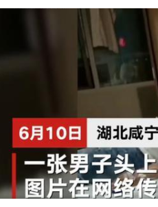 青年头插菜刀在医院等候治疗，此前未接到报案，正在进行调查。