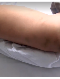 戒网瘾学校待三天全身多处淤青，小孩眼神呆滞，牙都没了