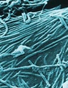 世界十大恐怖病毒都是什么？新型冠状病毒的特征是怎样的？